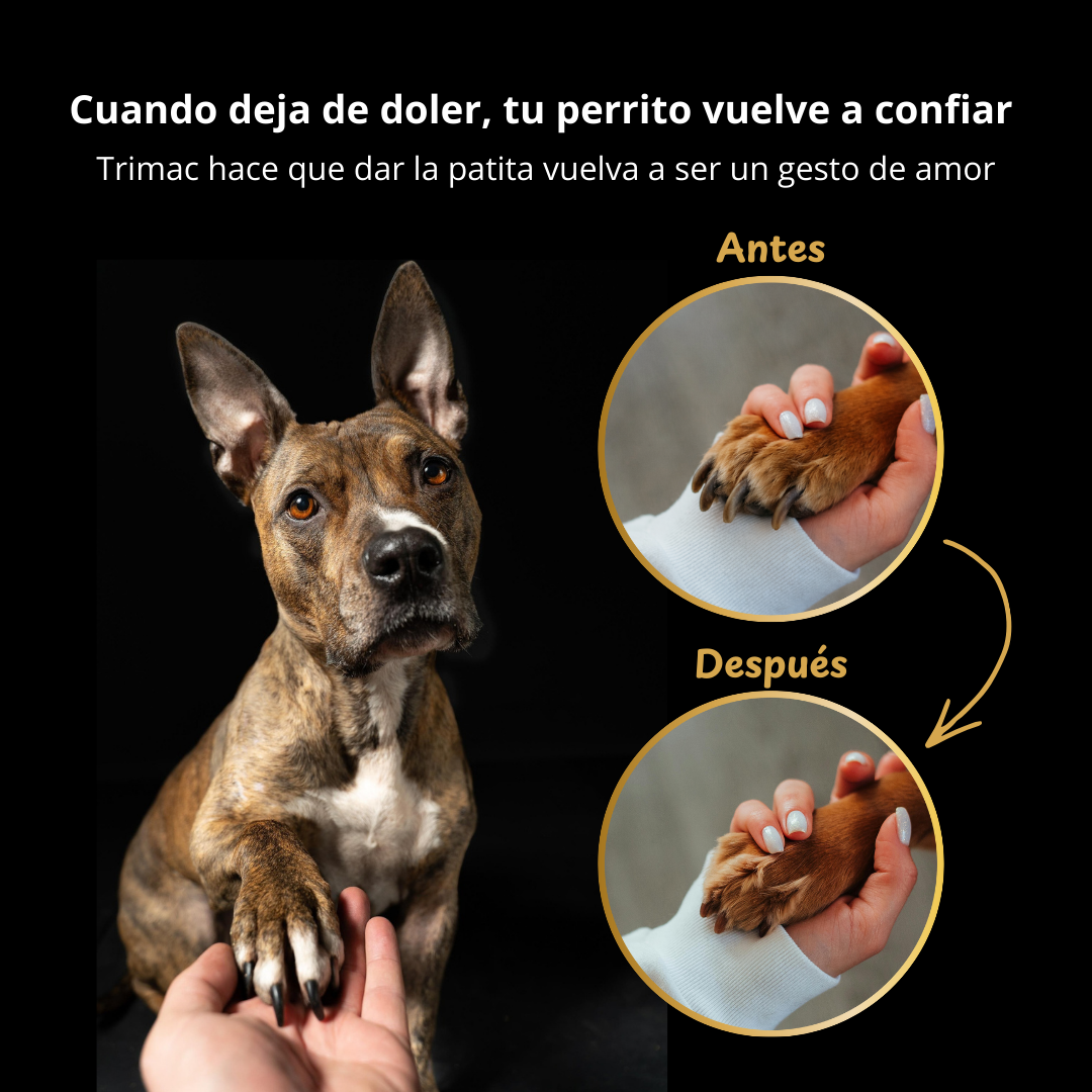 TrimacPro™ Cortauñas eléctrico con luz LED antisangrado